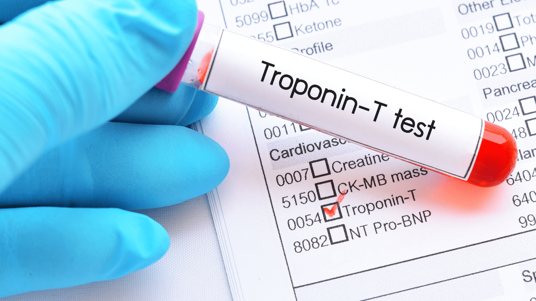 State of the art IVDR Troponin